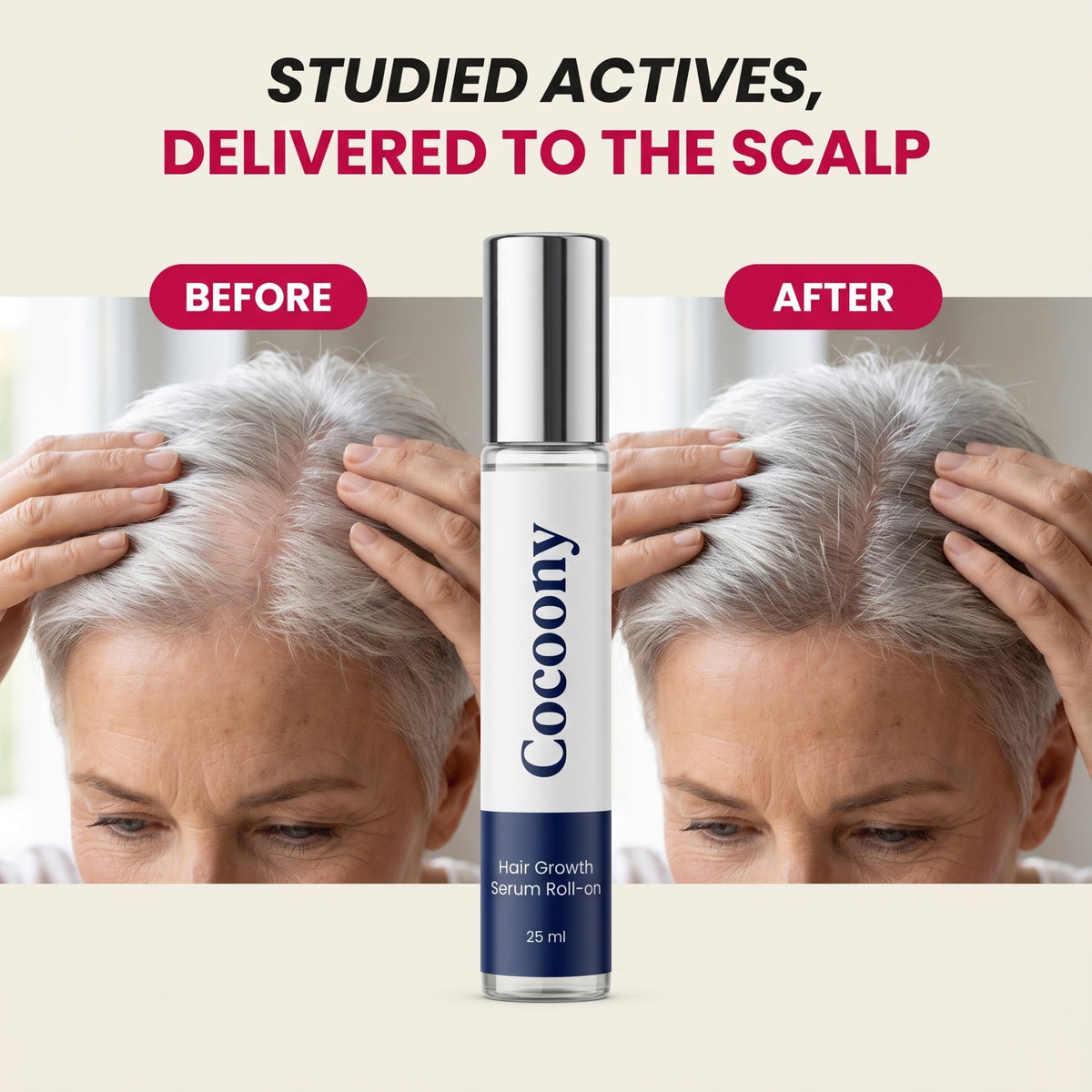 Studied actives delivered to the scalp, before and after part line