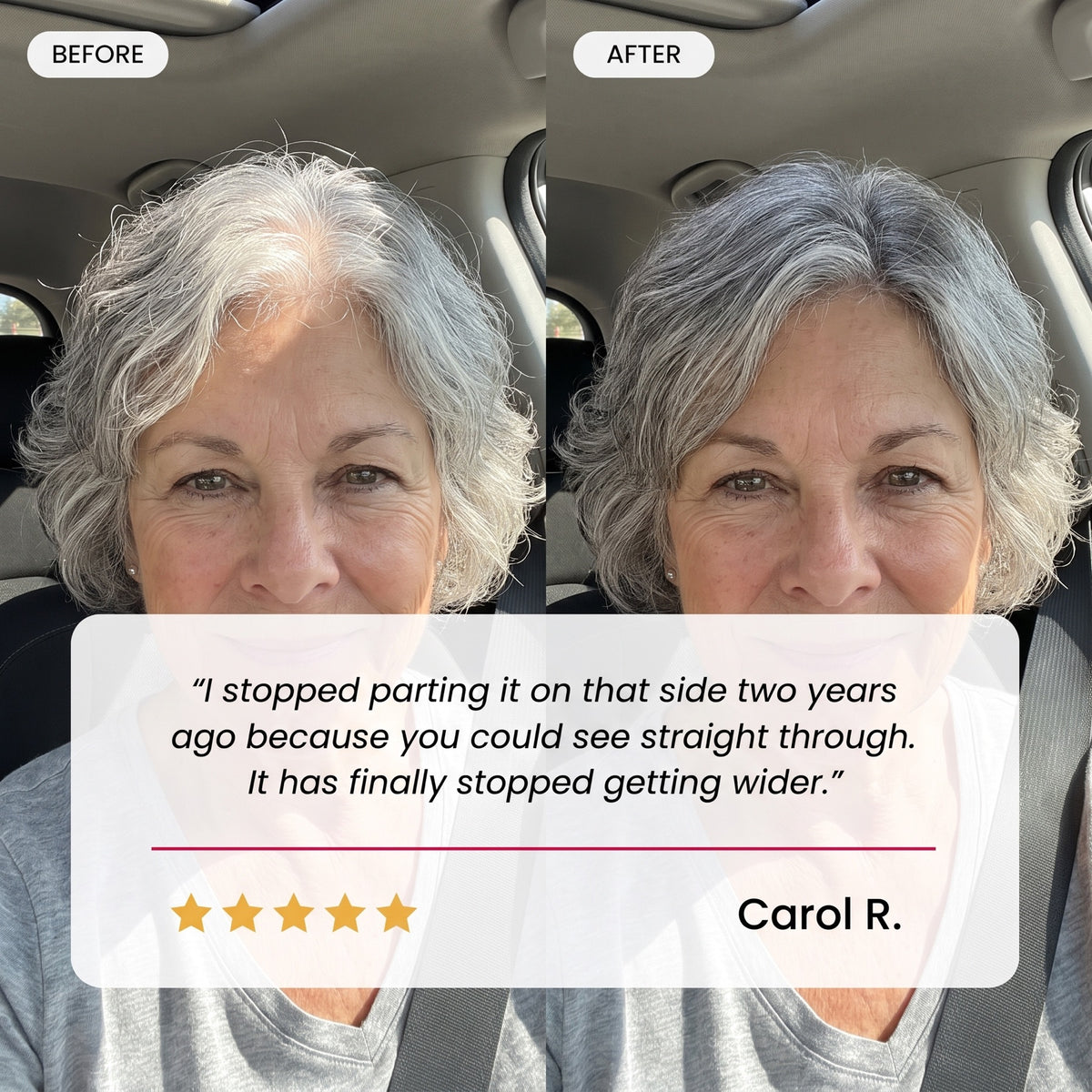 Customer testimonial from Carol R. with before and after