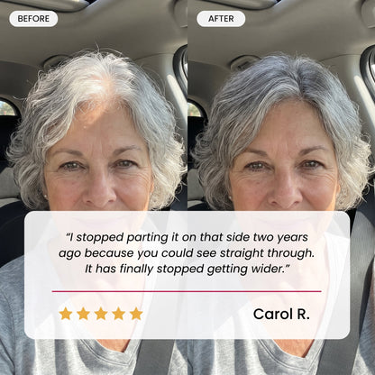 Customer testimonial from Carol R. with before and after