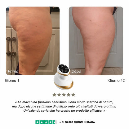 Celluviaa – Pelle più liscia in 14 giorni
