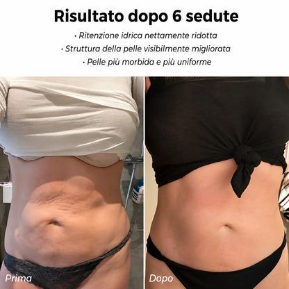 Celluviaa – Pelle più liscia in 14 giorni