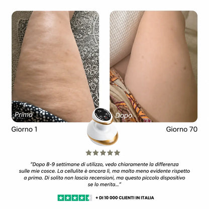 Celluviaa – Pelle più liscia in 14 giorni