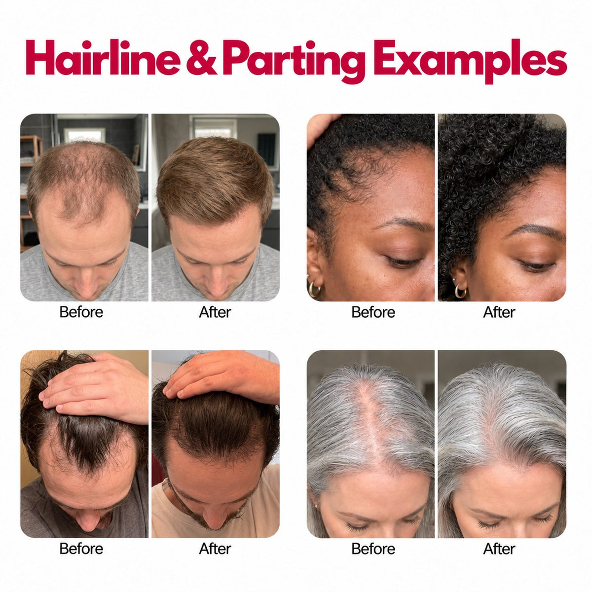 Cocoony hairline and parting examples, two men and two women